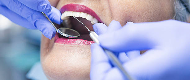 Best After-Hours Emergency Dentist in Mays Chapel, MD